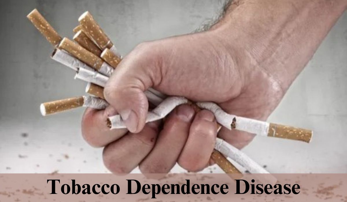 Tobacco Dependence Disease