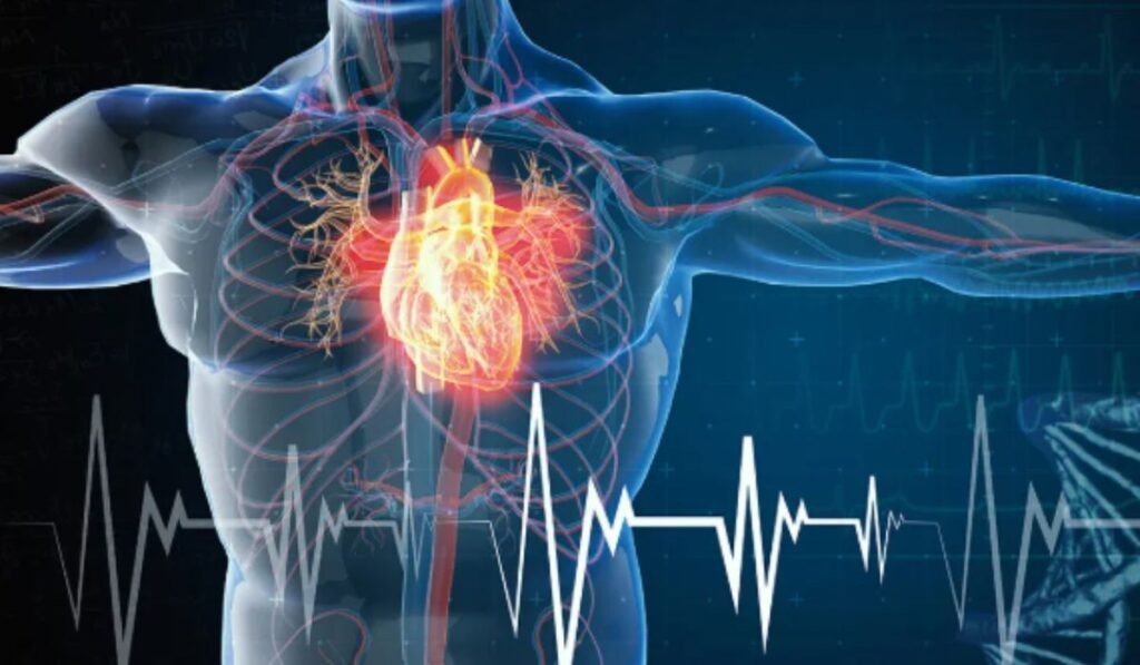 Cardiovascular Diseases