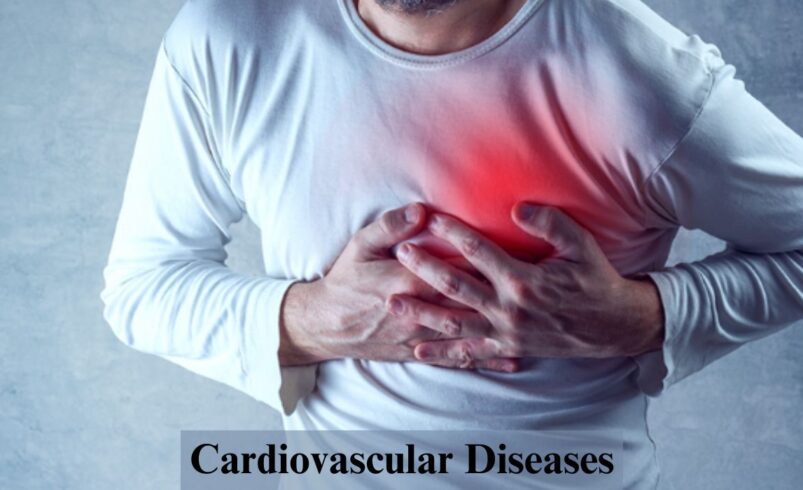 Cardiovascular Diseases