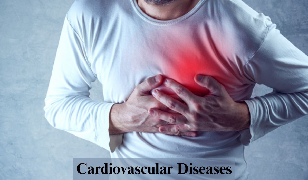 Cardiovascular Diseases: Causes, Prevention, and Lifestyle Changes