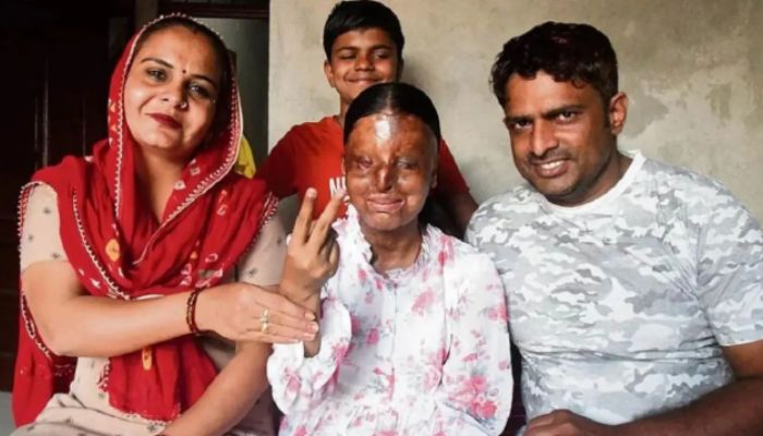 Acid attack survivor Kaafi clears CBSE 12th