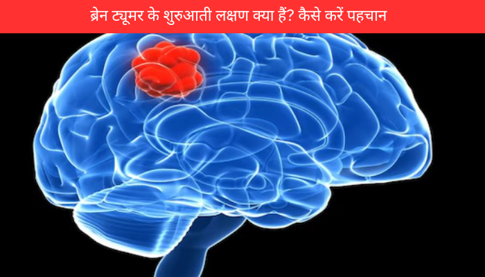 ब्रेन ट्यूमर के शुरुआती लक्षण क्या हैं? कैसे करें पहचान?