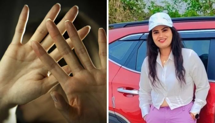 Kannada TV Actress Shruthi Survives Brutal Stabbing by Husband in Bengaluru: A Shocking Case of Domestic Violence
